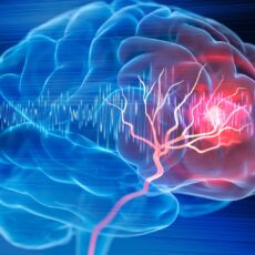 Image of brain damage