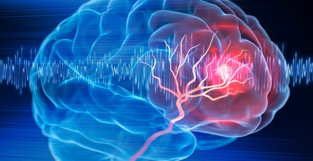 Image of brain damage