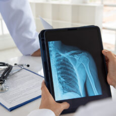 Doctor looking at X-ray