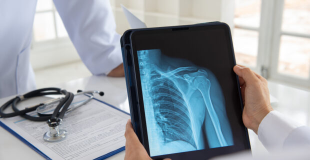 Doctor looking at X-ray