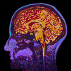 stroke compensation