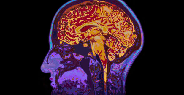 stroke compensation