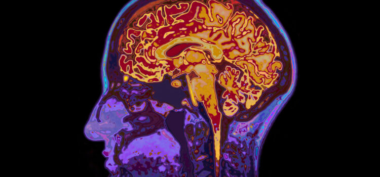 stroke compensation