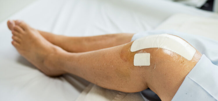 Faulty knee replacements Faulty knee replacements